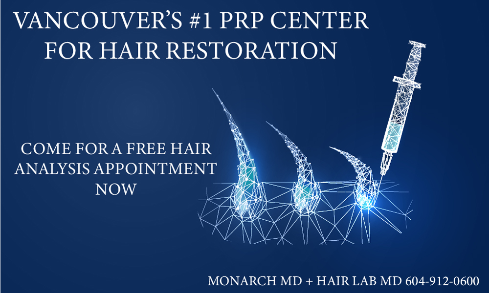 best PRP hair restoration clinic in vancouver